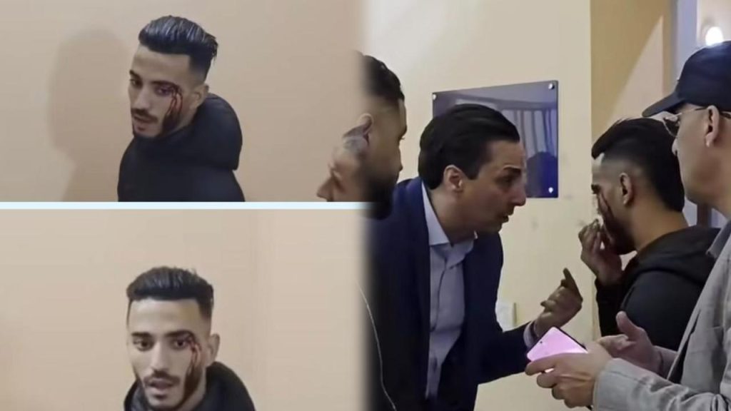 حادث بعد صافرة النهاية يشعل الجدل في قمة بركان والجيش الملكي
