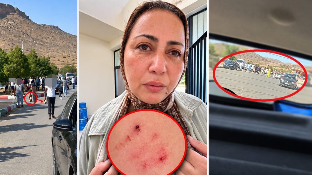 إصابة الصحافية فاطمة الزهراء الرجمي وسط اتهامات لمقربين من المرشح محمد أوزين بمنع التغطية الانتخابية